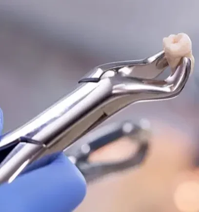 Удаление зуба под имплант