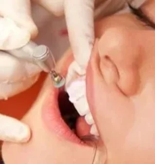 Альвеолэктомия в области 1 зуба