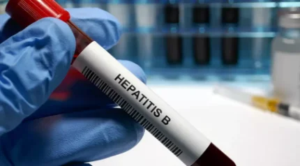 Анализ на вирус гепатита В (качественный)
