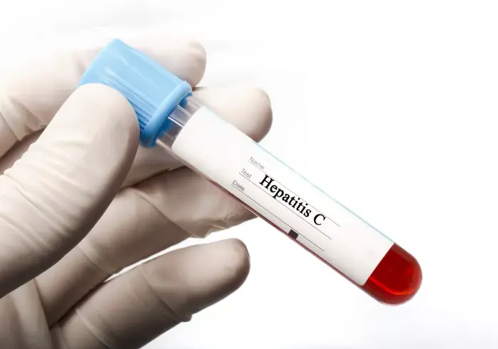 Анализ крови на гепатит С детям (качественный)