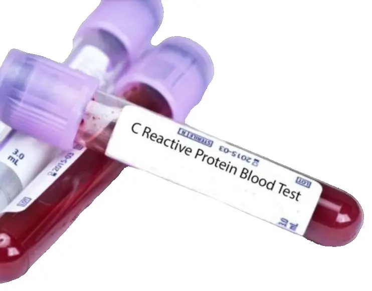 Исследование уровня С-реактивного белка в крови (количественный м-д)