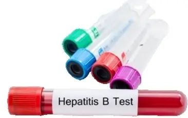 Определение антигена Hbs-Ag Hepatitis В virus (скрининг+тест)