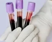 Анализ крови: Ревмофактор, Мочевина, Хлориды (Cl-), Холестерин