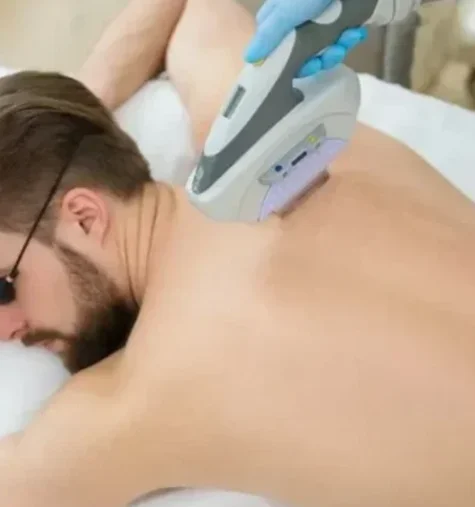 Лазерная эпиляция плеч у мужчин