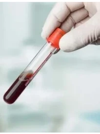 Анализ на альбумин