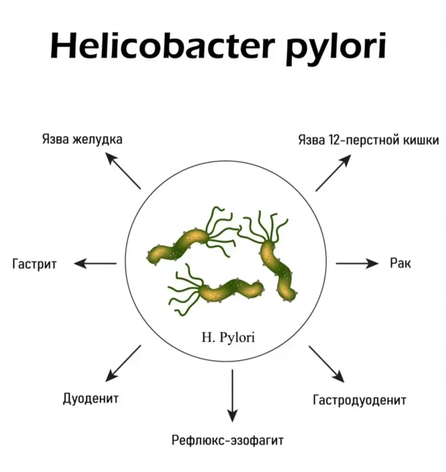 Антитела к Helicobacter pylori: иммуноферментный анализ. Helicobacter Pylori IgM (антитела класса IgM к Helicobacter pylori)