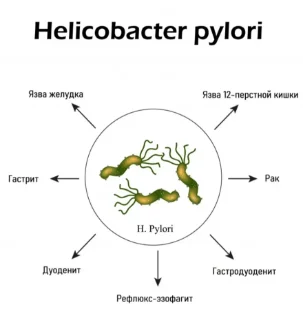 Фото для Антитела к Helicobacter pylori: иммуноферментный анализ. Helicobacter Pylori IgM (антитела класса IgM к Helicobacter pylori)